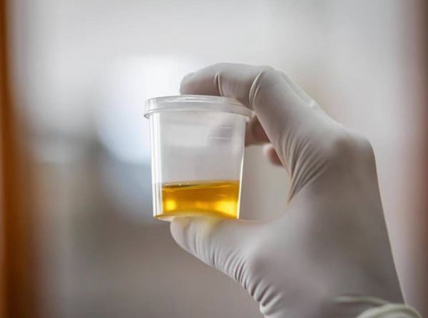 3efd1a1a1315d58d3a57fd547b60cbf1